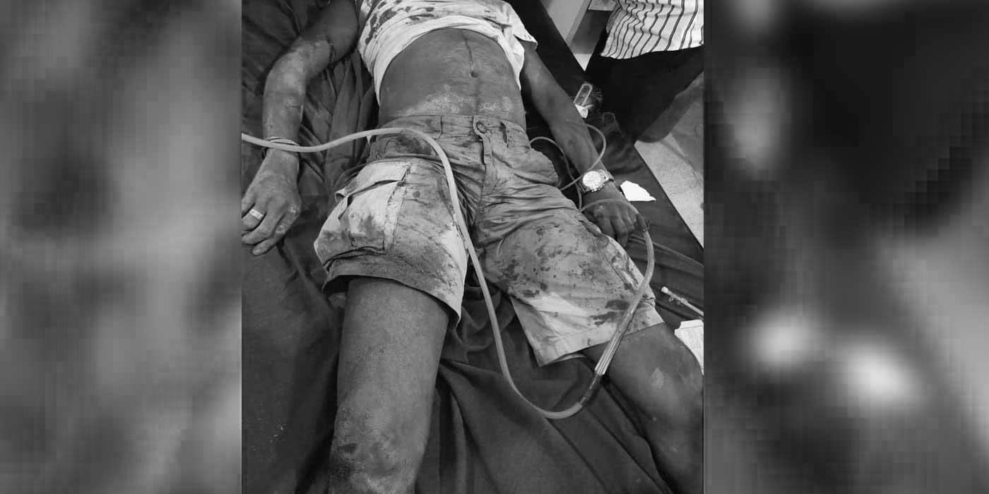 सर्लाहीमा गोली चल्दा एक युवक घाइते